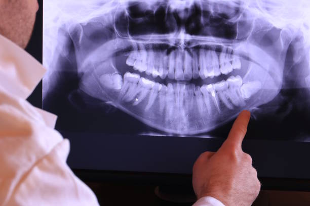 Best Emergency Dental Care for Trauma or Injury in Silver Springs, FL